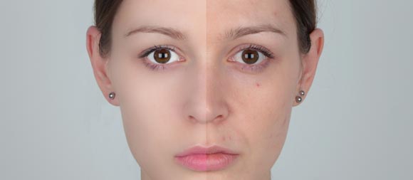 Model with and without retouching.